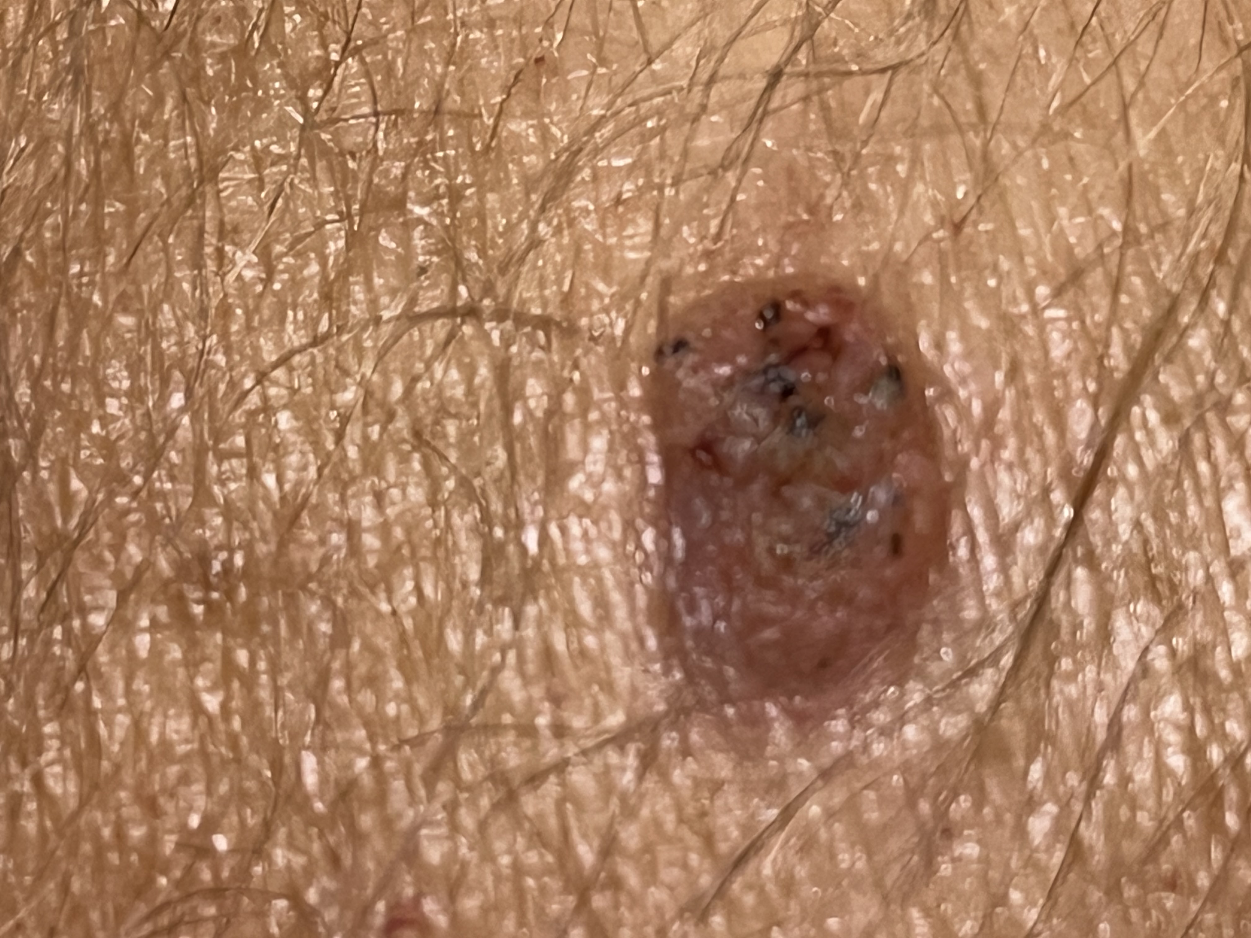 Znamínko obrázek 4