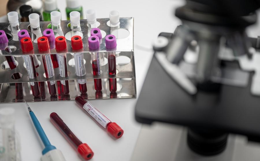 Laboratorní rozbory lidské krve, zdroj obrázku Pixbay.com