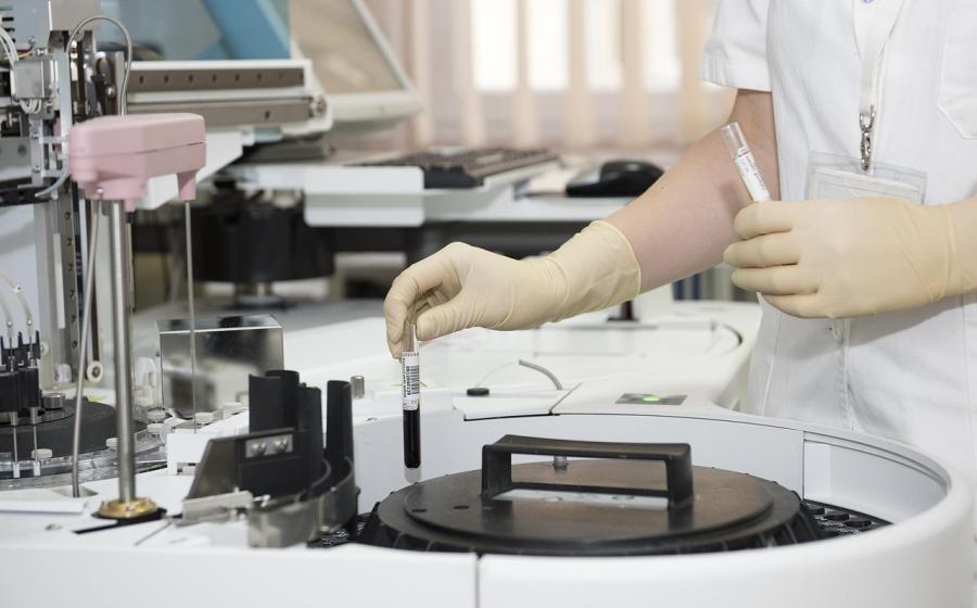 Laboratorní rozbory, autor obrázku Darko Stojanovic, zdroj Pixbay.com